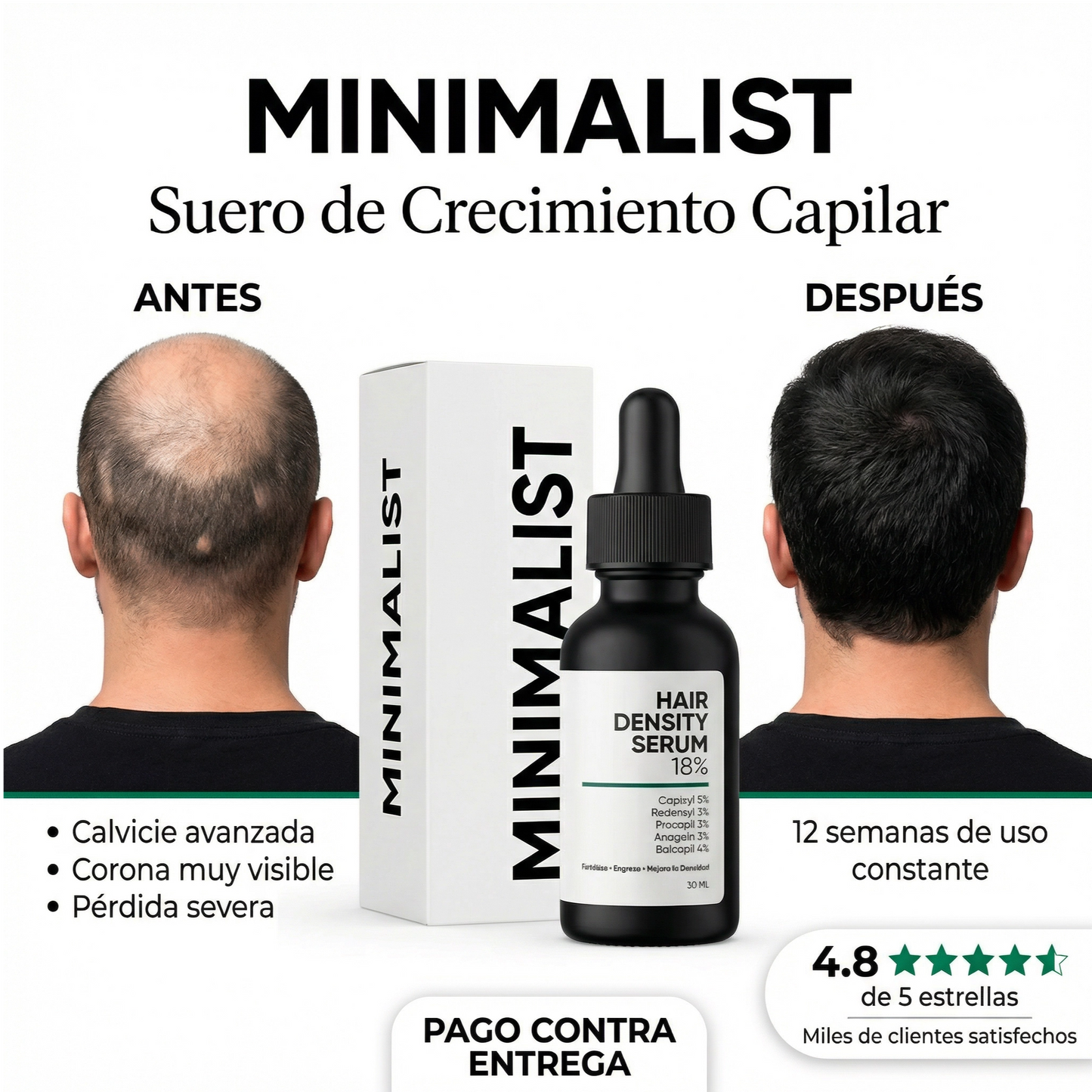 Sistema Capilar Reconstructor Pro!