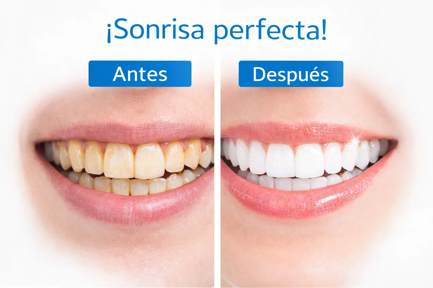 Blanqueador Dental