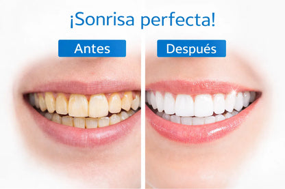 Blanqueador Dental